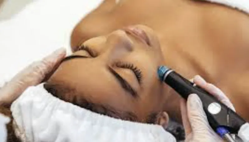 IV therapy at IZO Aesthetics & Wellness in Charlotte NC