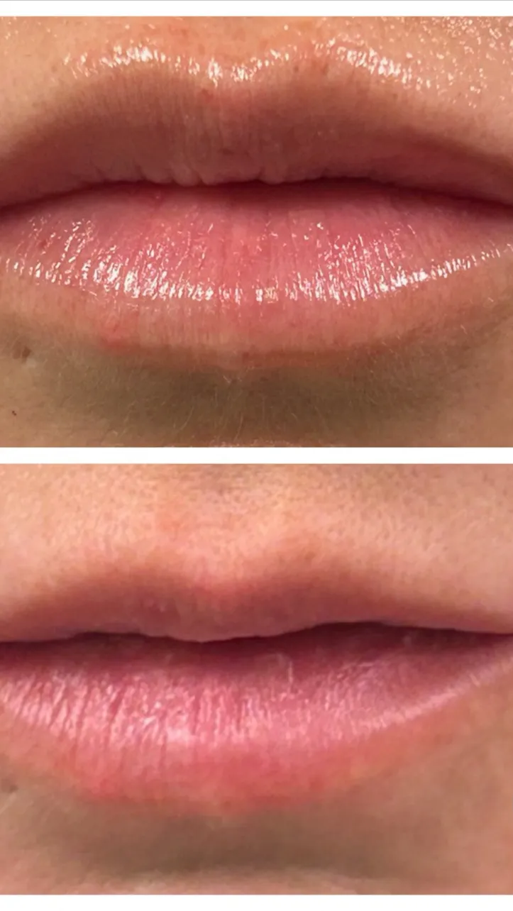 IV therapy at Rejuv Health Spa in New York NY