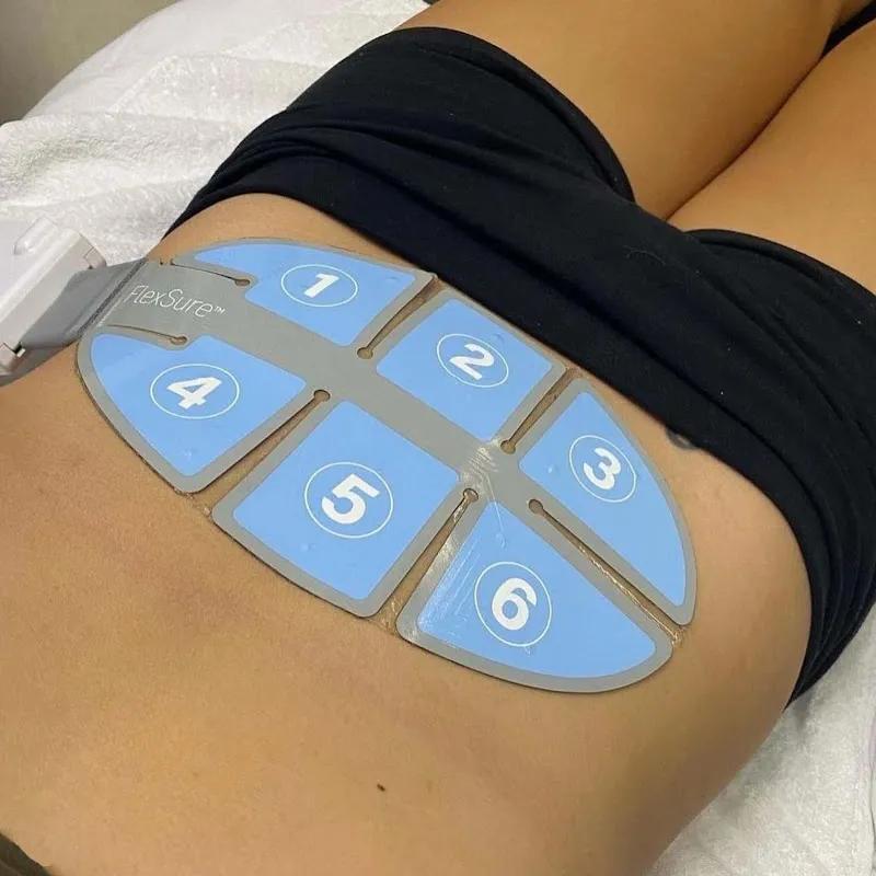 IV therapy at RenewMD Beauty and Wellness, a Medical Spa in Stockton in Stockton CA