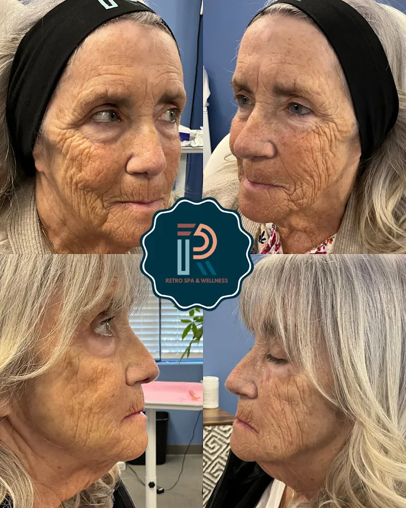 IV therapy at Retro Spa & Wellness, PLLC in Fayetteville NC